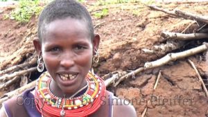 Samburu Woman with ritual tooth extraction